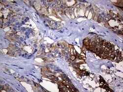 VIL1 Mouse anti-Human, Clone: OTI3B3, lyophilized, TrueMAB 100 &mu;g; Unconjugated:Antibodies,