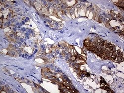 VIL1 Monoclonal Antibody (OTI3B3), TrueMAB , OriGene 100 &mu;L; Unconjugated:Antibodies,