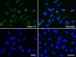 VIM Monoclonal Antibody (OTI1H10), TrueMAB , OriGene:Antibodies:Primary