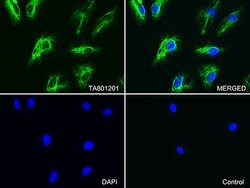 VIM Mouse anti-Human, Clone: OTI11C11, lyophilized, TrueMAB 100 &mu;g;