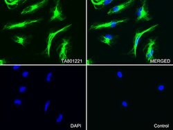 VIM Mouse anti-Human, Clone: OTI3B11, lyophilized, TrueMAB 100 &mu;g; Unconjugated:Antibodies,
