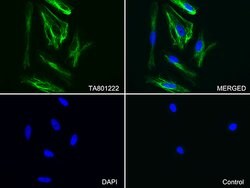 VIM Monoclonal Antibody (OTI7F5), TrueMAB , OriGene:Antibodies:Primary