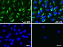 VIM Mouse anti-Human, Clone: OTI5D7, lyophilized, TrueMAB 100 &mu;g; Unconjugated:Antibodies,