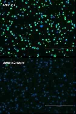 VIM Monoclonal Antibody (OTI1D3), TrueMAB , OriGene 100 &mu;L; Unconjugated:Antibodies,