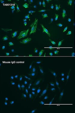 VIM Monoclonal Antibody (OTI1D3), TrueMAB , OriGene 100 &mu;L; Unconjugated:Antibodies,
