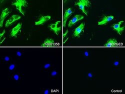 VIM Monoclonal Antibody (OTI7B8), TrueMAB , OriGene 100 &mu;L; Unconjugated:Antibodies,