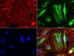 VIM Mouse anti-Human, Clone: UMAB159, liquid, UltraMAB 100 &mu;L | Buy Online | Origene Technologies | Fisher Scientific