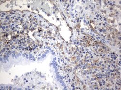 VIM Mouse anti-Human, Clone: OTI5D7, lyophilized, TrueMAB 100 &mu;g; Unconjugated:Antibodies,