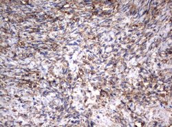 VIM Mouse anti-Human, Clone: OTI5D7, lyophilized, TrueMAB 100 &mu;g; Unconjugated:Antibodies,