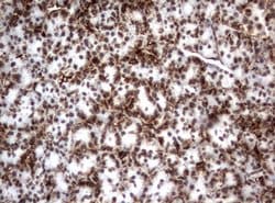 VIM Mouse anti-Human, Clone: OTI5D7, lyophilized, TrueMAB 100 &mu;g; Unconjugated:Antibodies,