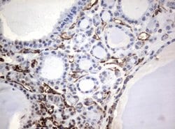 VIM Mouse anti-Human, Clone: OTI5D7, lyophilized, TrueMAB 100 &mu;g; Unconjugated:Antibodies,