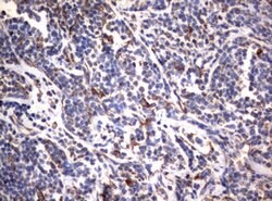 VIM Mouse anti-Human, Clone: OTI5D7, lyophilized, TrueMAB 100 &mu;g; Unconjugated:Antibodies,