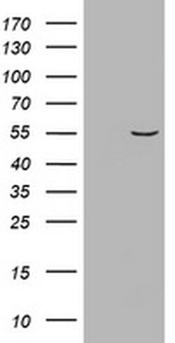 VIM Monoclonal Antibody (OTI1H10), TrueMAB , OriGene 100 &mu;L; Unconjugated:Antibodies,