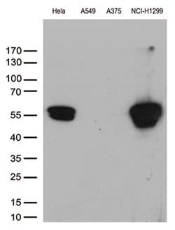 VIM Monoclonal Antibody (OTI1H10), TrueMAB , OriGene 100 &mu;L; Unconjugated:Antibodies,