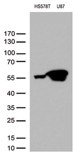 VIM Monoclonal Antibody (OTI1H10), TrueMAB , OriGene 100 &mu;L; Unconjugated:Antibodies,