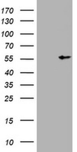 VIM Monoclonal Antibody (OTI3G4), TrueMAB , OriGene 100 &mu;L; Unconjugated:Antibodies,
