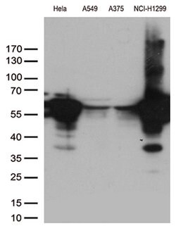 VIM Monoclonal Antibody (OTI3G4), TrueMAB , OriGene 100 &mu;L; Unconjugated:Antibodies,