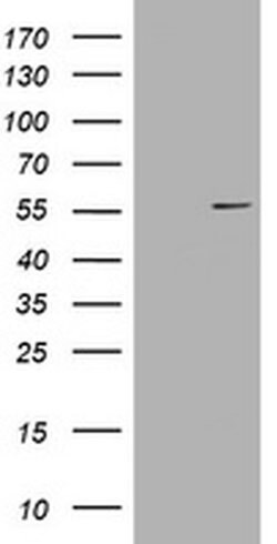 VIM Monoclonal Antibody (OTI2F7), TrueMAB , OriGene 100 &mu;L; Unconjugated:Antibodies,