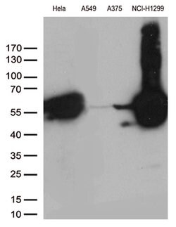 VIM Monoclonal Antibody (OTI2F7), TrueMAB , OriGene:Antibodies:Primary