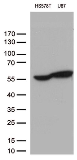 VIM Monoclonal Antibody (OTI2F7), TrueMAB , OriGene:Antibodies:Primary