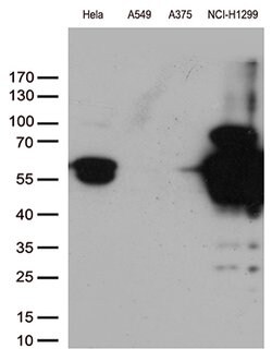 VIM Mouse anti-Human, Clone: OTI11C11, lyophilized, TrueMAB 100 &mu;g;