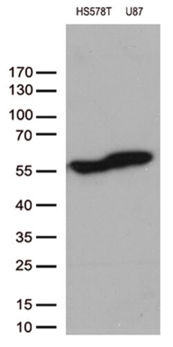VIM Mouse anti-Human, Clone: OTI11C11, lyophilized, TrueMAB 100 &mu;g;