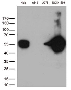 VIM Mouse anti-Human, Clone: OTI3B11, lyophilized, TrueMAB 100 &mu;g; Unconjugated:Antibodies,