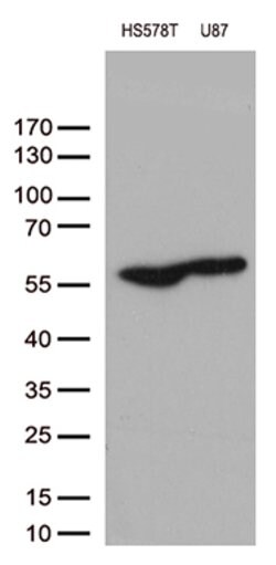 VIM Mouse anti-Human, Clone: OTI3B11, lyophilized, TrueMAB 100 &mu;g; Unconjugated:Antibodies,
