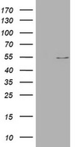 VIM Monoclonal Antibody (OTI7F5), TrueMAB , OriGene 100 &mu;L; Unconjugated:Antibodies,