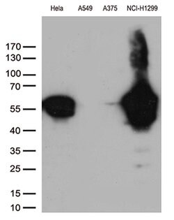 VIM Monoclonal Antibody (OTI7F5), TrueMAB , OriGene 100 &mu;L; Unconjugated:Antibodies,