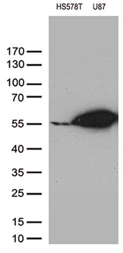 VIM Monoclonal Antibody (OTI7F5), TrueMAB , OriGene 100 &mu;L; Unconjugated:Antibodies,