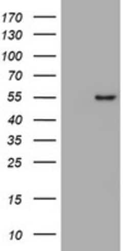 VIM Mouse anti-Human, Clone: OTI5D7, lyophilized, TrueMAB 100 &mu;g; Unconjugated:Antibodies,