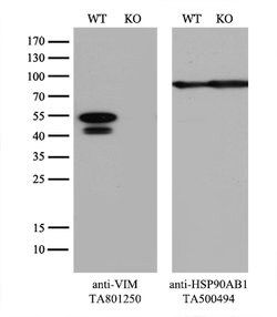 VIM Mouse anti-Human, Clone: OTI5D7, lyophilized, TrueMAB 100 &mu;g; Unconjugated:Antibodies,