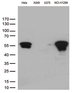VIM Mouse anti-Human, Clone: OTI5D7, lyophilized, TrueMAB 100 &mu;g; Unconjugated:Antibodies,