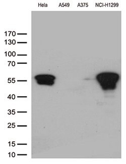 VIM Monoclonal Antibody (OTI5D7), TrueMAB , OriGene 100 &mu;L; Unconjugated:Antibodies,