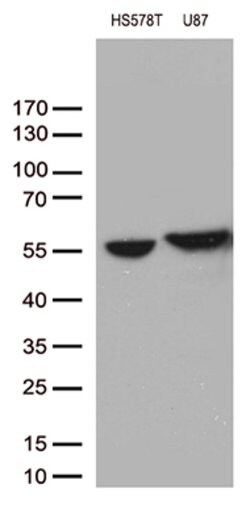 VIM Mouse anti-Human, Clone: OTI5D7, lyophilized, TrueMAB 100 &mu;g; Unconjugated:Antibodies,