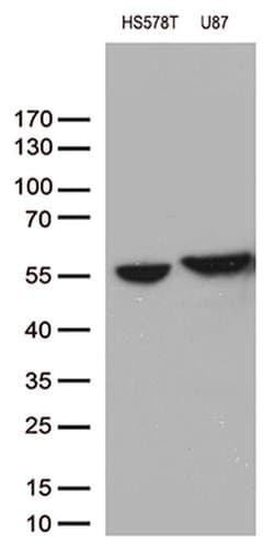 VIM Monoclonal Antibody (OTI5D7), TrueMAB , OriGene:Antibodies:Primary