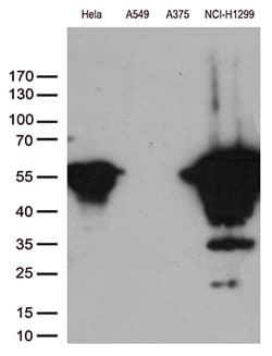 VIM Mouse anti-Human, Clone: OTI2C4, lyophilized, TrueMAB 100 &mu;g; Unconjugated:Antibodies,