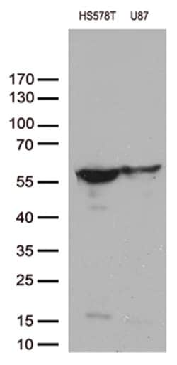 VIM Mouse anti-Human, Clone: OTI2C4, lyophilized, TrueMAB 100 &mu;g; Unconjugated:Antibodies,
