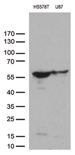 VIM Monoclonal Antibody (OTI2C4), TrueMAB , OriGene 100 &mu;L; Unconjugated:Antibodies,