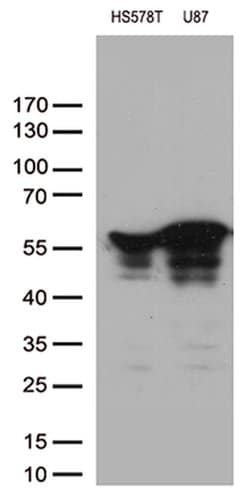 VIM Monoclonal Antibody (OTI1D3), TrueMAB , OriGene 100 &mu;L; Unconjugated:Antibodies,