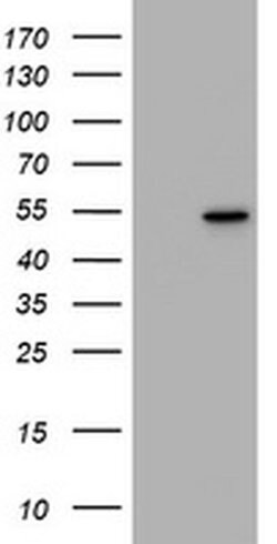 VIM Monoclonal Antibody (OTI7B8), TrueMAB , OriGene 100 &mu;L; Unconjugated:Antibodies,