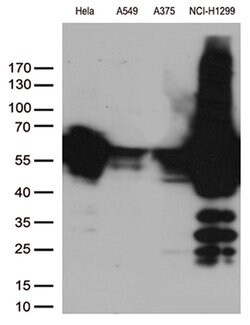 VIM Monoclonal Antibody (OTI7B8), TrueMAB , OriGene 100 &mu;L; Unconjugated:Antibodies,