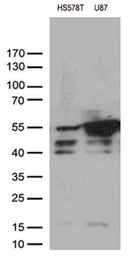 VIM Monoclonal Antibody (OTI7B8), TrueMAB , OriGene 100 &mu;L; Unconjugated:Antibodies,