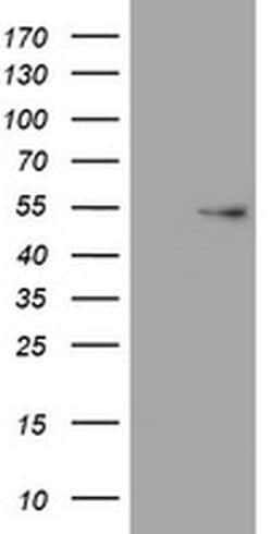 VIM Monoclonal Antibody (OTI1G6), TrueMAB , OriGene 100 &mu;L; Unconjugated:Antibodies,