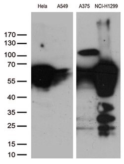 VIM Monoclonal Antibody (OTI1G6), TrueMAB , OriGene 100 &mu;L; Unconjugated:Antibodies,