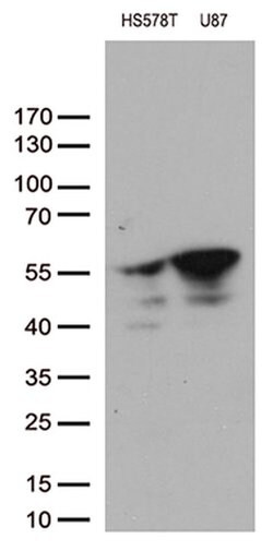 VIM Monoclonal Antibody (OTI1G6), TrueMAB , OriGene 100 &mu;L; Unconjugated:Antibodies,