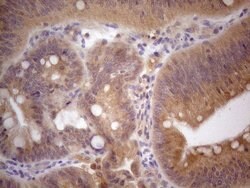 VIP Monoclonal Antibody (OTI5B5), TrueMAB , OriGene 100 &mu;L; Unconjugated:Antibodies,