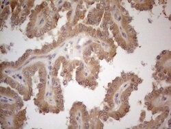 VIP Monoclonal Antibody (OTI5B5), TrueMAB , OriGene 100 &mu;L; Unconjugated:Antibodies,