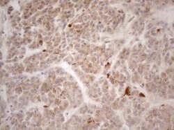 VIP Monoclonal Antibody (OTI5B5), TrueMAB , OriGene 100 &mu;L; Unconjugated:Antibodies,